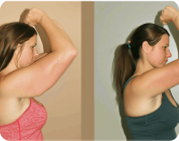 MyoGlow user Suzie K.